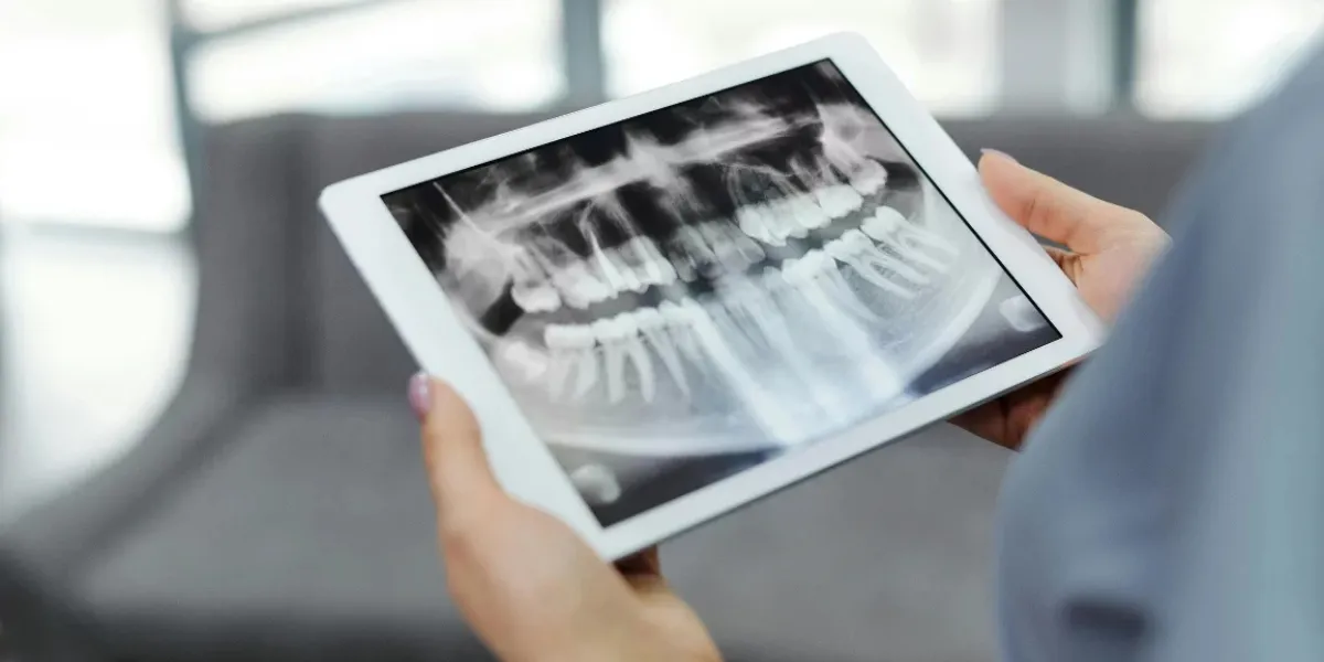 endodontologie behandlung